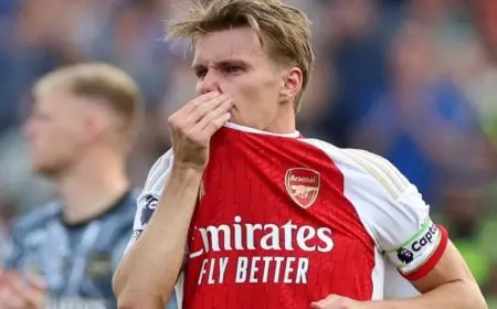 شكوك حول لحاق أوديغارد بديربي شمال لندن بسبب إصابة صعبة