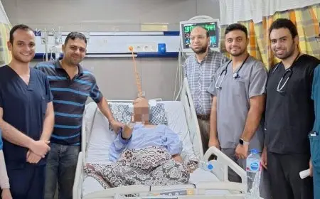 الصحة تعلن نجاح الفريق الطبي بمعهد القلب القومي بإجراء قسطرة معقدة بإستخدام جهاز الإيكمو