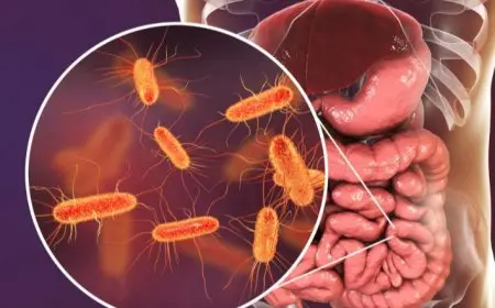 بعد تسببها في إصابة أهالي أسوان.. ما هي أعراض البكتيريا الإشريكية القولونية؟