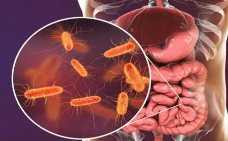 بعد إصابات أسوان.. طريقة العلاج والوقاية من بكتيريا الايكولاي