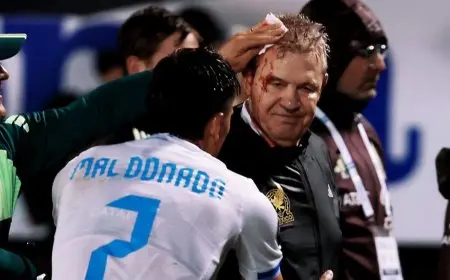 عبوة مياه تجرح مدرب المكسيك خافيير أغيري في رأسه بعد مواجهة هندوراس