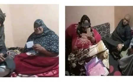 الصحة والتضامن تتكاتفان لإنقاذ سيدة تعاني من السمنة المفرطة