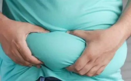 حسام موافي يحذر من خطر السمنة: السبب الرئيسي للأمراض المزمنة