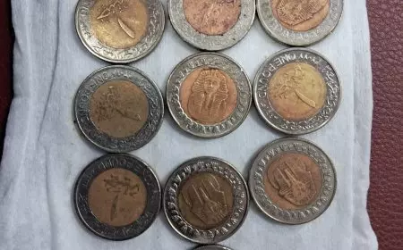 استخراج 13 جنيهًا معدنيًا من معدة طفل بمستشفى المنصورة