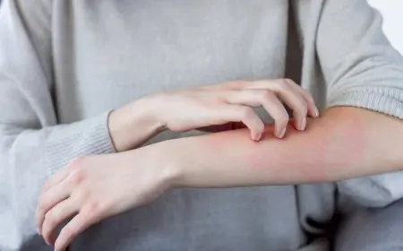 كيف تتعامل مع العاصفة الترابية؟ نصائح لمرضى الحساسية خلال موسم تقلبات الطقس