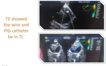 الرعاية الصحية تحقق إنجازًا تاريخيًا بإجراء تدخل جراحي مزدوج لأول مرة في إقليم جنوب الصعيد