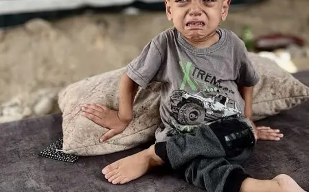 وفاة الطفل الفلسطيني عبد الله صاحب عبارة “أنا جائع”