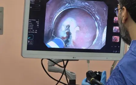 لأول مرة في المحافظة.. استخدام الذكاء الاصطناعي يحقق نجاحًا في مناظير القولون بمجمع السويس الطبي