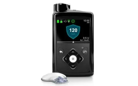 بنكرياس صناعي لعلاج السكري بتكلفة 400 ألف جنيه قريبًا في مصر