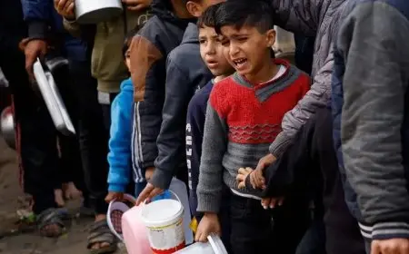 صحة غزة: زيادة وفيات التجويع إلى 348 شخصاً، بينهم 127 طفلاً