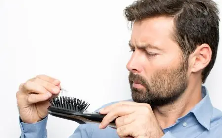 أضرار العزوبية على الصحة: استشاري نفسي يوضح تأثيرها ومخاطر تساقط الشعر