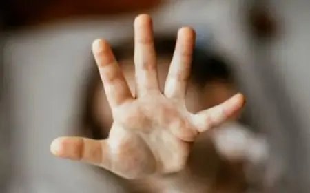 تحذيرات خطيرة: حوادث الاعتداء في المدارس تهدد نمو الأطفال وتعيق تقدمهم