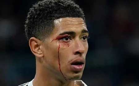 ريال مدريد المتعثر يتلقى هزيمة مؤلمة بتسعة لاعبين أمام سيلتا فيغو