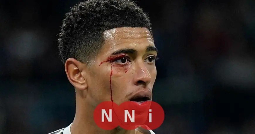 ريال مدريد المتعثر يتلقى هزيمة مؤلمة بتسعة لاعبين أمام سيلتا فيغو