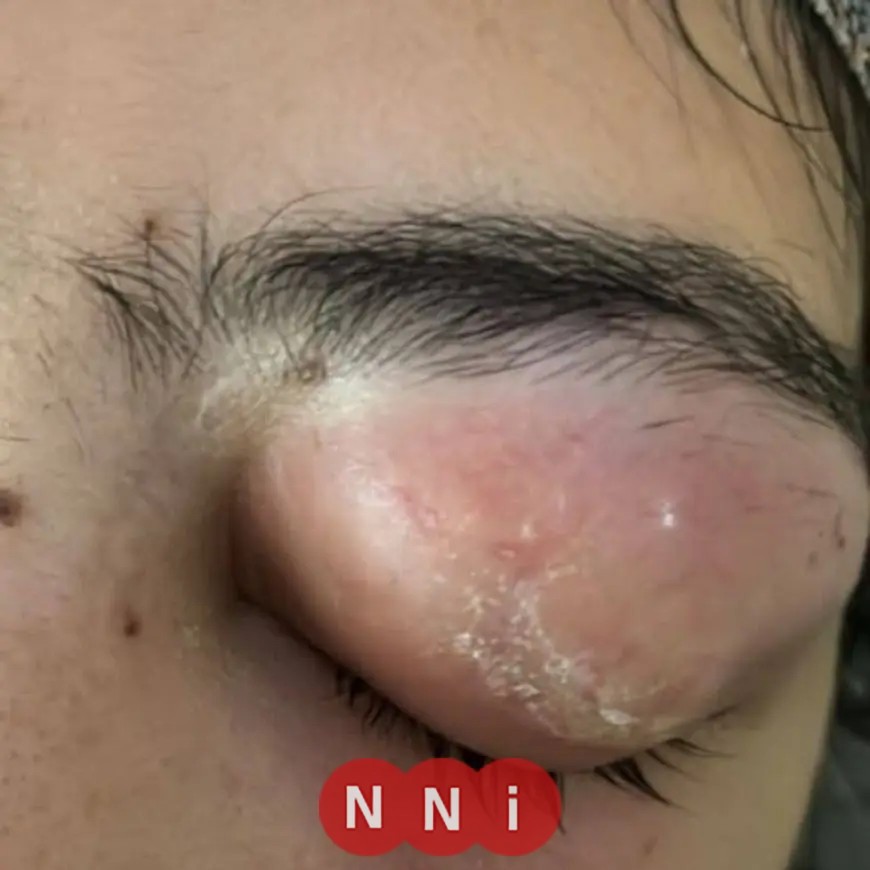 مستشفى جامعة الأزهر بأسيوط تنجح في إعادة البصر لمريضة بعد عقد من فقدانها