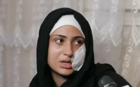 ضحية دار السلام تروي معاناتها: 12 سنة من العنف الزوجي و80 غرزة في الوجه