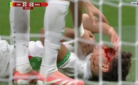 إصابة خطيرة لنائل العيناوي في مباراة المغرب والسنغال