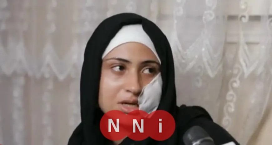 ضحية دار السلام تروي معاناتها: 12 سنة من العنف الزوجي و80 غرزة في الوجه