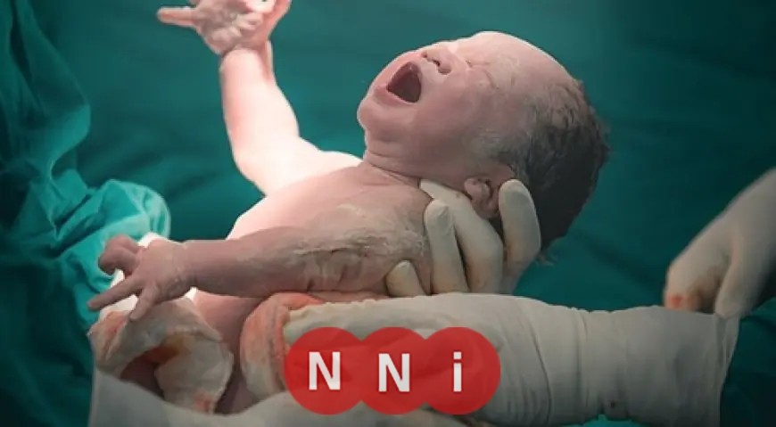 تحذيرات طبية حول مخاطر الولادة القيصرية وحرمان الطفل من البكتيريا النافعة