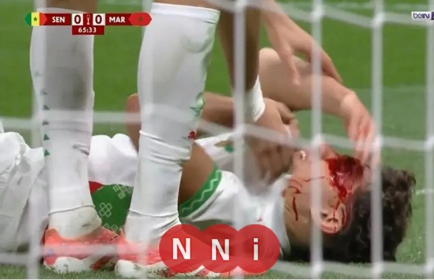 إصابة خطيرة لنائل العيناوي في مباراة المغرب والسنغال