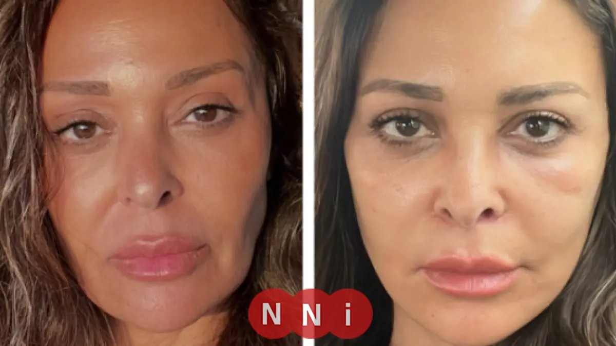 اكتشف سر عملية شد الوجه والرقبة لداليا البحيري التي أبهرت الجميع