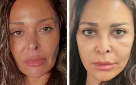 اكتشف سر عملية شد الوجه والرقبة لداليا البحيري التي أبهرت الجميع