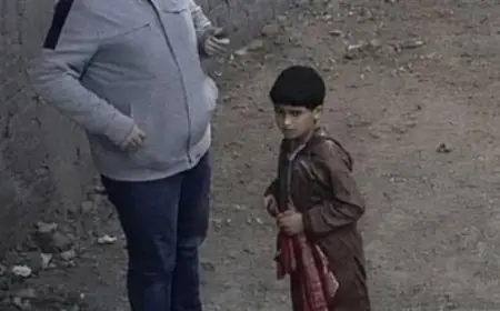 جمال شعبان يقدم تفاصيل إنقاذ ساق طفل باسوس من البتر