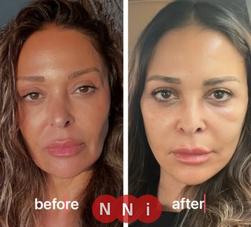 اكتشف سر عملية شد الوجه والرقبة لداليا البحيري التي أبهرت الجميع