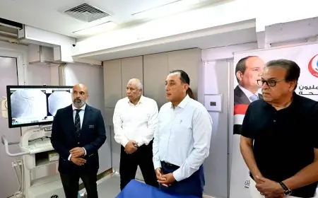 رئيس الوزراء مدبولي يستعرض الوحدة المتنقلة لعلاج السكتات الدماغية والتدخلات القلبية والعصبية والعضلية