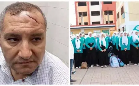 تفاصيل صادمة: إصابة مدير مدرسة بالدقهلية بـ17 غرزة في الرأس بعد اعتداء المعلمين