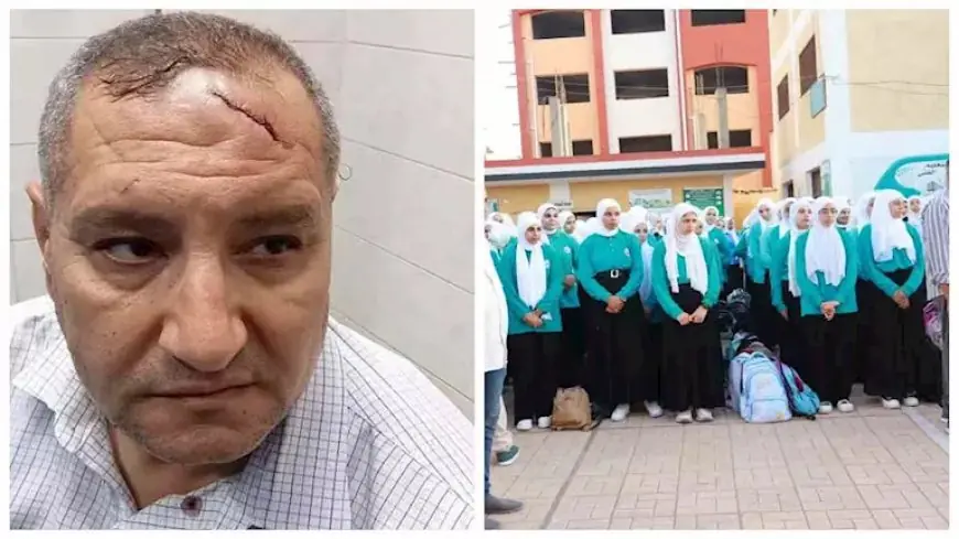 تفاصيل صادمة: إصابة مدير مدرسة بالدقهلية بـ17 غرزة في الرأس بعد اعتداء المعلمين