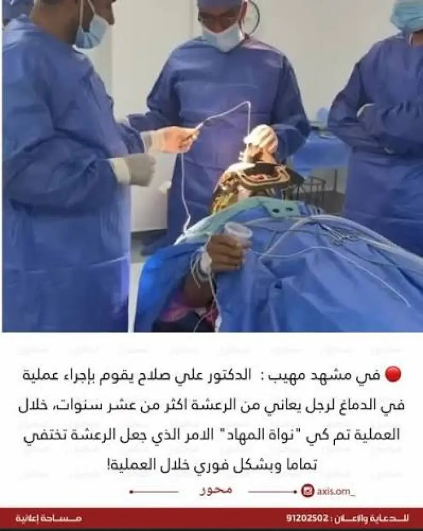 استشاري يكشف تفاصيل عملية جراحية دقيقة لعلاج الرعاش أثناء يقظة المريض