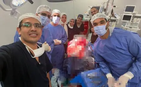 مسمار معدني في الرأس تفاصيل عملية جراحية مذهلة استغرقت 4 ساعات بمستشفى قصر العيني