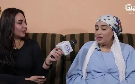 ضحى خالد تتحدى المستحيل بعد 21 عملية جراحية وخمس سنوات من المعاناة